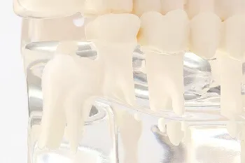 親知らずとは