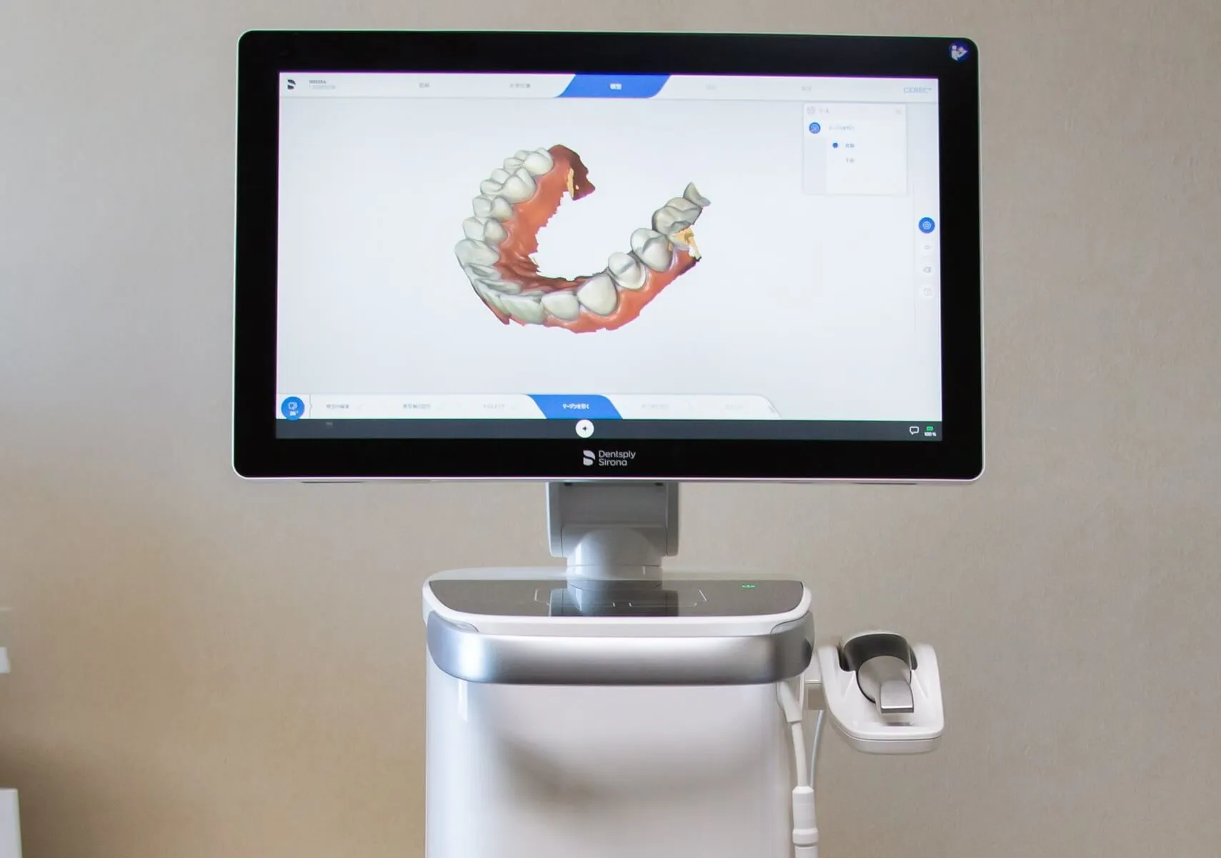 歯を削った後、3Dカメラで口腔内を撮影します