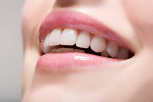 歯の白さの基準ってあるの？ホワイトニングの白さについて
