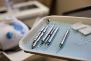 歯周病治療の前提となる歯周病検査とは