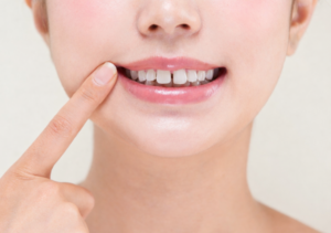 歯並びが悪いのは遺伝だけじゃない？知らないうちに悪化するNG習慣とは