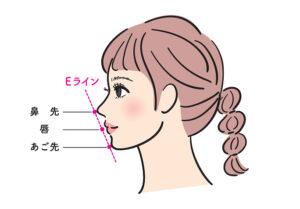 Eラインとは?横顔がきれいに見える理由と矯正で叶う変化